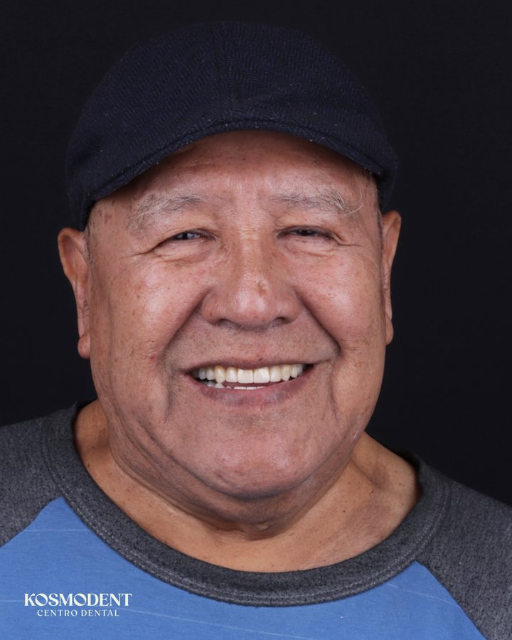 Después de rehabilitación oral en Kosmodent, dentista en Cumbres, Monterrey